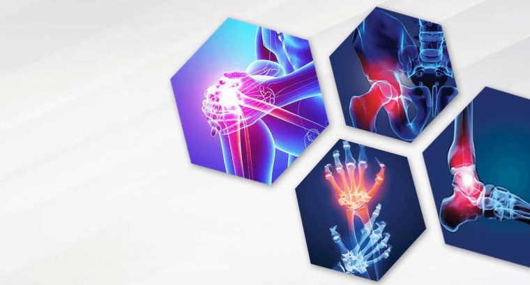 Knee pain treatment in coimbatore – vgmorthocentre.com